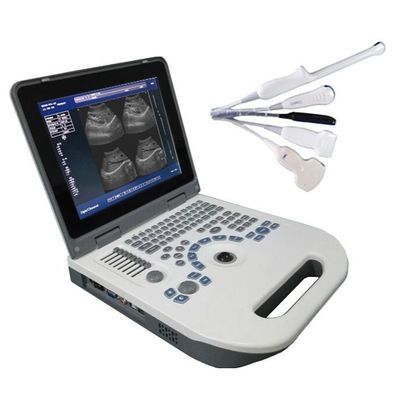 Calidad  TGC Control Notebook Ultrasound Scanner For Pregnancy Home Use Fábrica