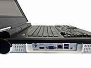 Máquina de ultrasonido portátil de color LED de 15 pulgadas con ángulo de escaneo de 60 grados y sonda de configuración 2.0MHz-5.0MHz