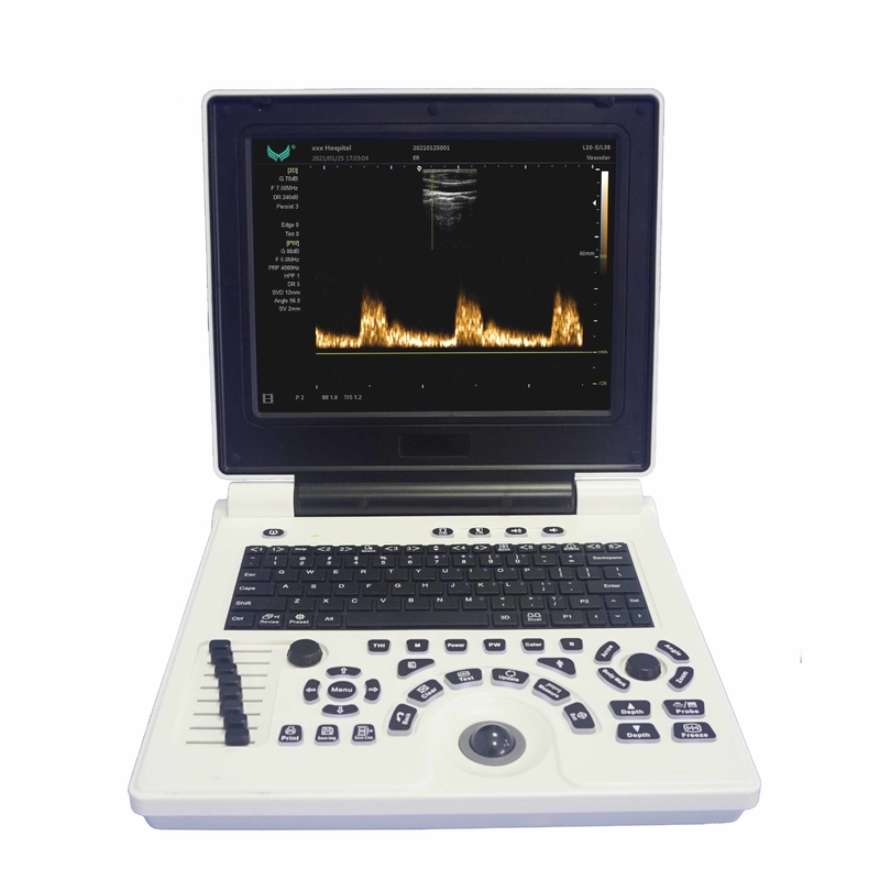 Máquina portátil del ultrasonido de Doppler del color de OB GYN en embarazo