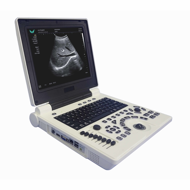 Máquina portátil del ultrasonido de Doppler del color de OB GYN en embarazo