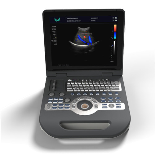 Dispositivo del ultrasonido de Doppler del PDA del escáner 220V del ultrasonido del color de la cardiología del SGS