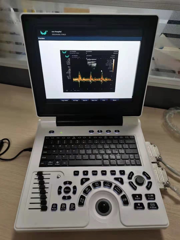 El ultrasonido de Doppler del color del embarazo de Xianfeng trabaja a máquina al OEM de las imágenes 4B
