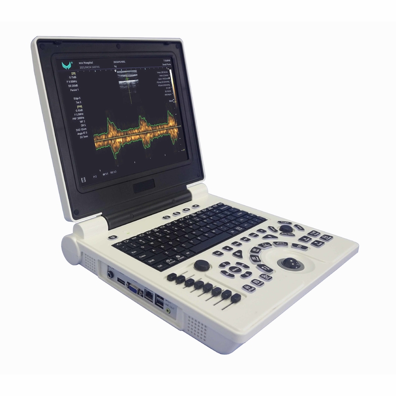 El ultrasonido de Doppler del color del embarazo de Xianfeng trabaja a máquina al OEM de las imágenes 4B