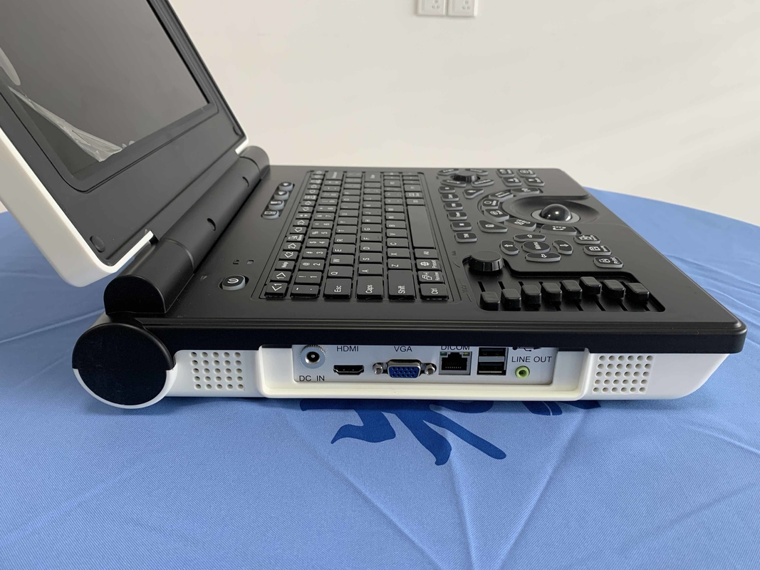 Batería portátil del escáner 3200mAh del ultrasonido de Doppler del color del sistema Win7