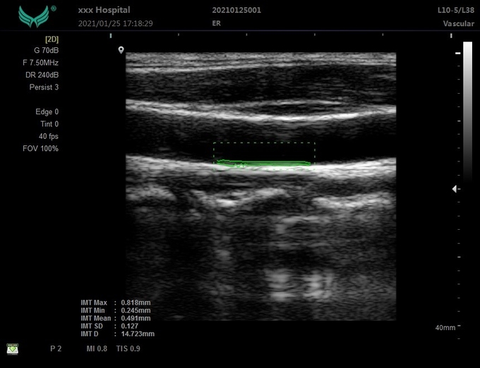 Máquina veterinaria portátil del ultrasonido 3D del OEM para 6 hospitalarios clínicos