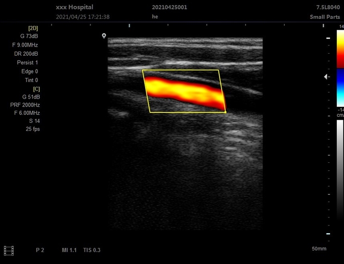 Máquina veterinaria portátil del ultrasonido 3D del OEM para 5 hospitalarios clínicos