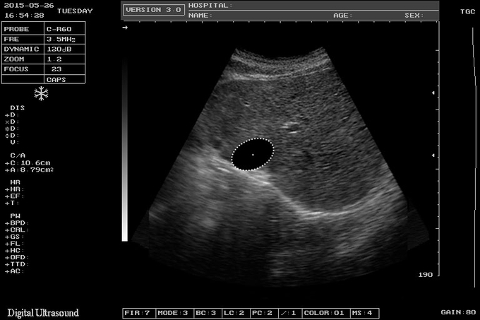 Máquina de la exploración del cuaderno USG de la exploración del electrón del ISO para obstetricia y ginecología 8