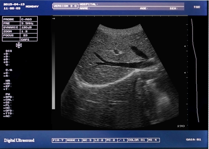 Máquina portátil DRF RDA 6 del ultrasonido del veterinario equino multiusos