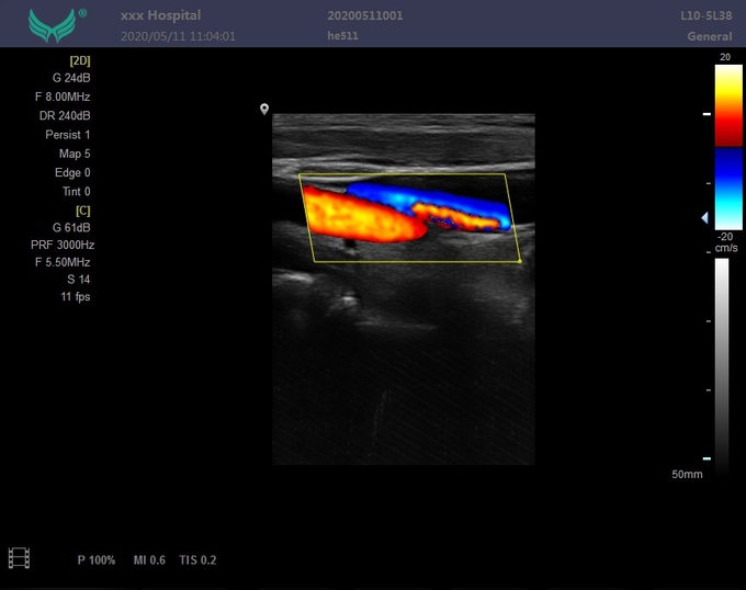 Modo abdominal 7 del picovatio CFM PDI de la máquina del ultrasonido de Doppler de la exploración de la clase II