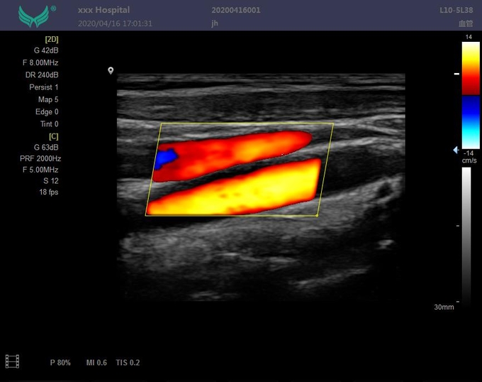 Modo abdominal 6 del picovatio CFM PDI de la máquina del ultrasonido de Doppler de la exploración de la clase II