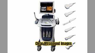 Escáner de ultrasonido Doppler PW CFM Modo PDI