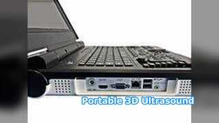 Hospital Clínico Ultrasonido Portátil E20