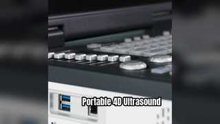 Máquina de ultrasonido Doppler 4D portátil lista para UCI