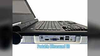 Exploración de urología con ultrasonido Doppler color portátil E0